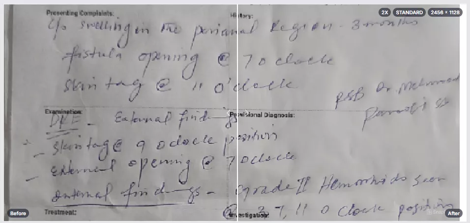 snapedit before vs after