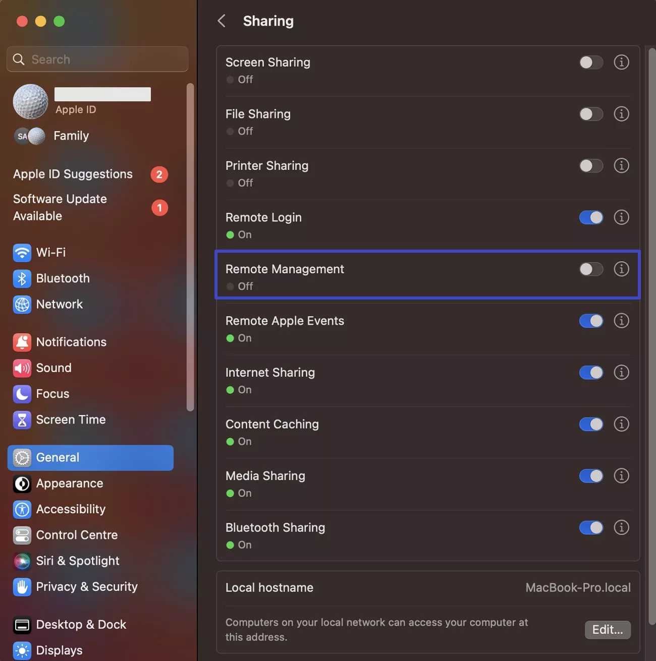 disable remote management toggle